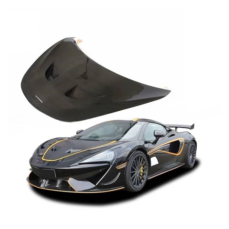 Kompatibel mit McLaren Motorhaube Dry Carbon Auto Fronthaube 620r Carbon Fiber 540C 570s Motorhaubenabdeckungen von CXYLOVELG