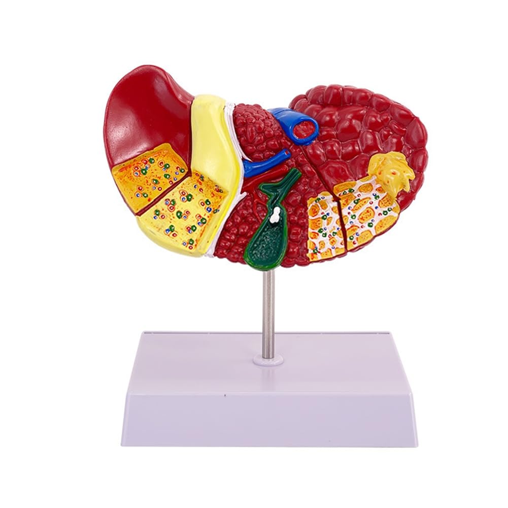 Muuoeou Lebermodell Menschliche Anatomie Lebermodell für Häufige Pathologien, Lebermodell Menschliche Anatomie Arztpraxis Anatomiemodell von Muuoeou