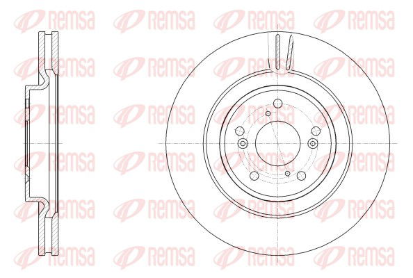 Bremsscheibe Vorderachse Remsa 62557.10 von Remsa